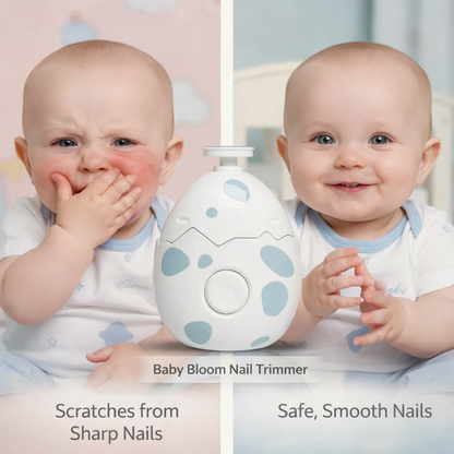 Safe Electric Baby Nail Trimmer – No Tears, No Pain for Newborns